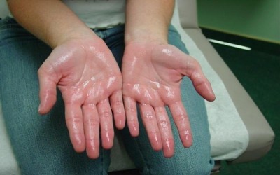 Paru-Paru Basah vs Hiperhidrosis: Salah Kaprah yang Masih Banyak Dipercaya Orang